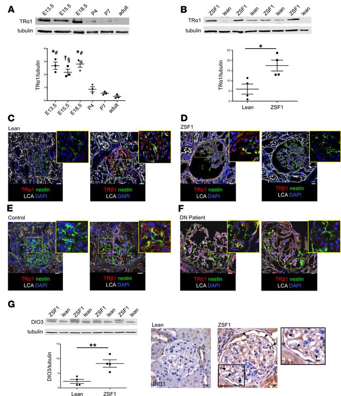Adoption of fetal expression pattern of TRs and DIO3 during DN.
(A) West...