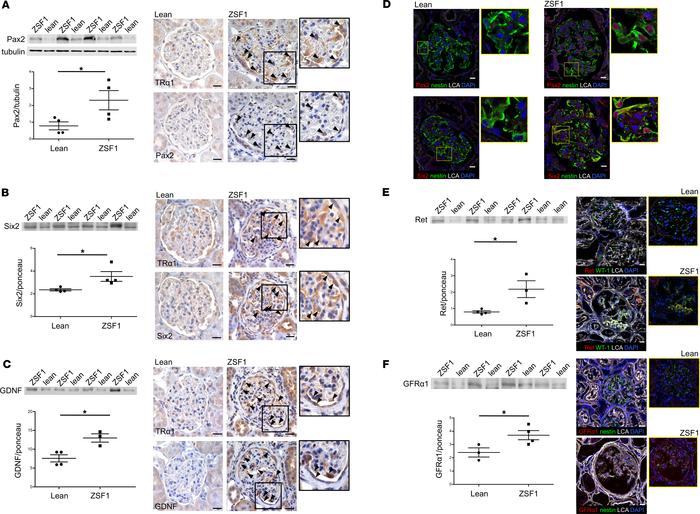 TRα1 reexpression is associated with reactivation of kidney developmenta...