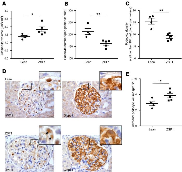 JCI Insight - Alteration of thyroid hormone signaling triggers the ...