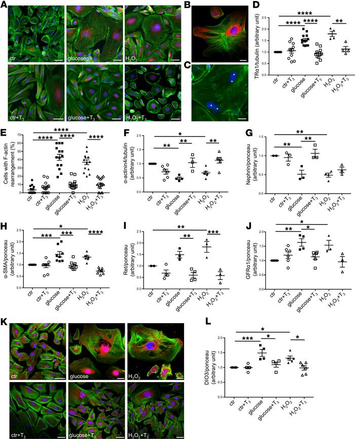 High glucose and oxidative stress induce TRα1 reexpression and podocyte ...