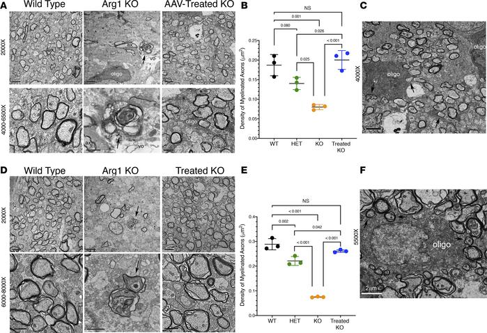 Analysis of axons in pyramidal tract and spinal cord of P15 mice demonst...