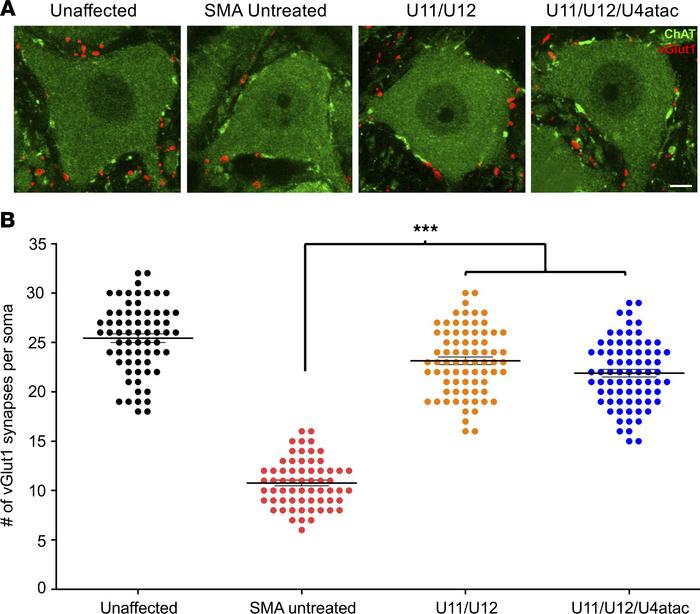 Loss of proprioceptive synapses onto motor neurons is rescued by minor s...