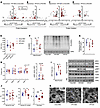 Aerobic exercise prevents increased damage to mitochondrial proteins and gr