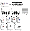 Metformin reverses brain insulin resistance and impairments in mitochondria