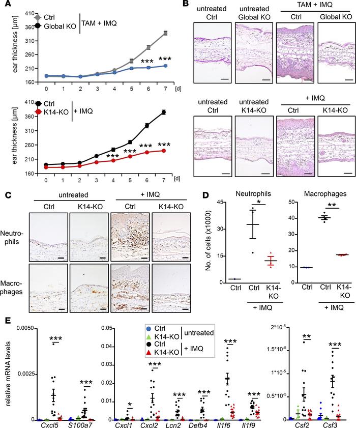 Keratinocyte-specific deletion of IκBζ protects against IMQ-induced psor...
