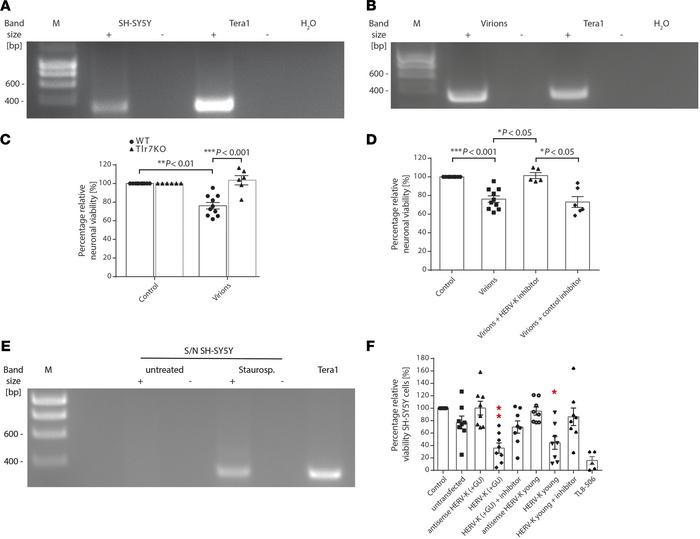 Endogenous HERV-K transcripts trigger neurodegeneration.
(A) SH-SY5Y cel...