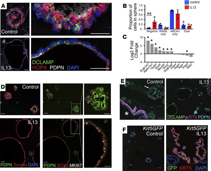 JCI Insight - Interleukin-13 disrupts type 2 pneumocyte stem cell