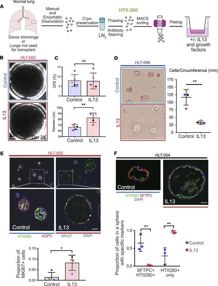 Human lung cell culture.
(A) Schematic for processing of normal human lu...