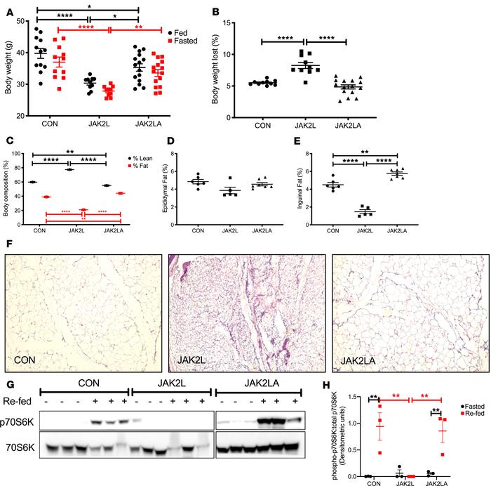 JAK2L mice are lipodystrophic and have a defective fasted-to-fed respons...