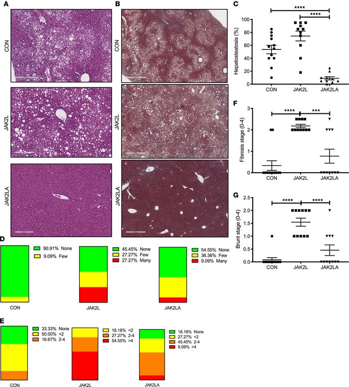Loss of hepatocyte Jak2 promotes NAFLD and NASH in an adipocyte Jak2–dep...