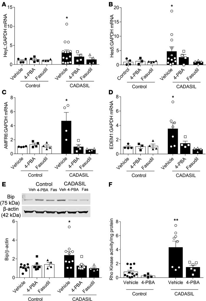 Interplay between Notch3, ER stress, and Rho kinase in CADASIL VSMCs.
(A...