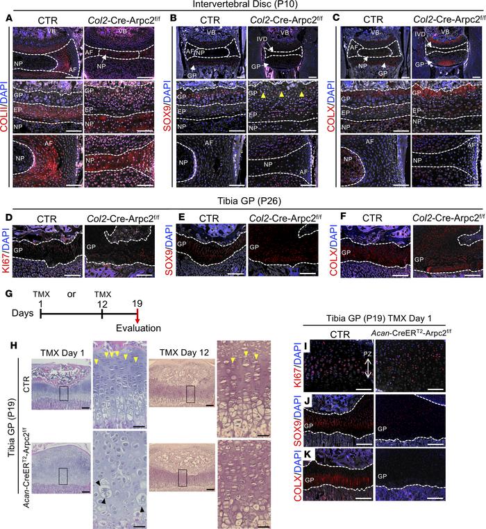 Impact of Arp2/3 inactivation on disc and chondrogenic cell markers.
(A–...
