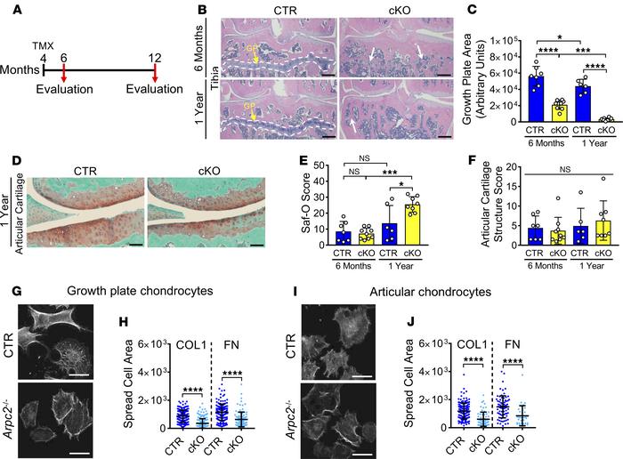 Postnatal inactivation of Arp2/3 causes growth plate closure and articul...