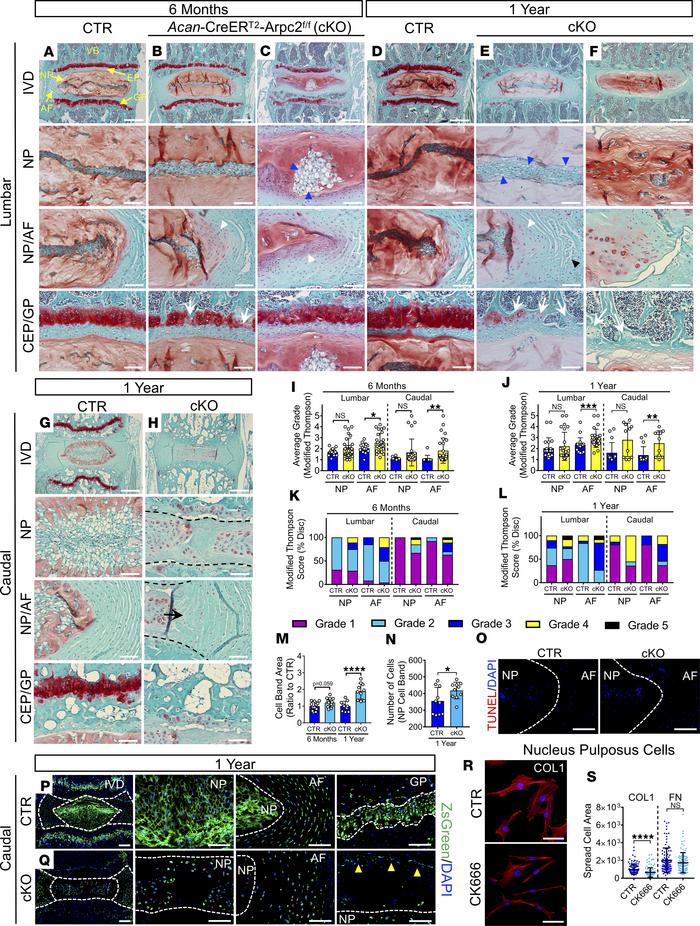 Inactivation of Arp2/3 at skeletal maturity causes disc degeneration.
(A...