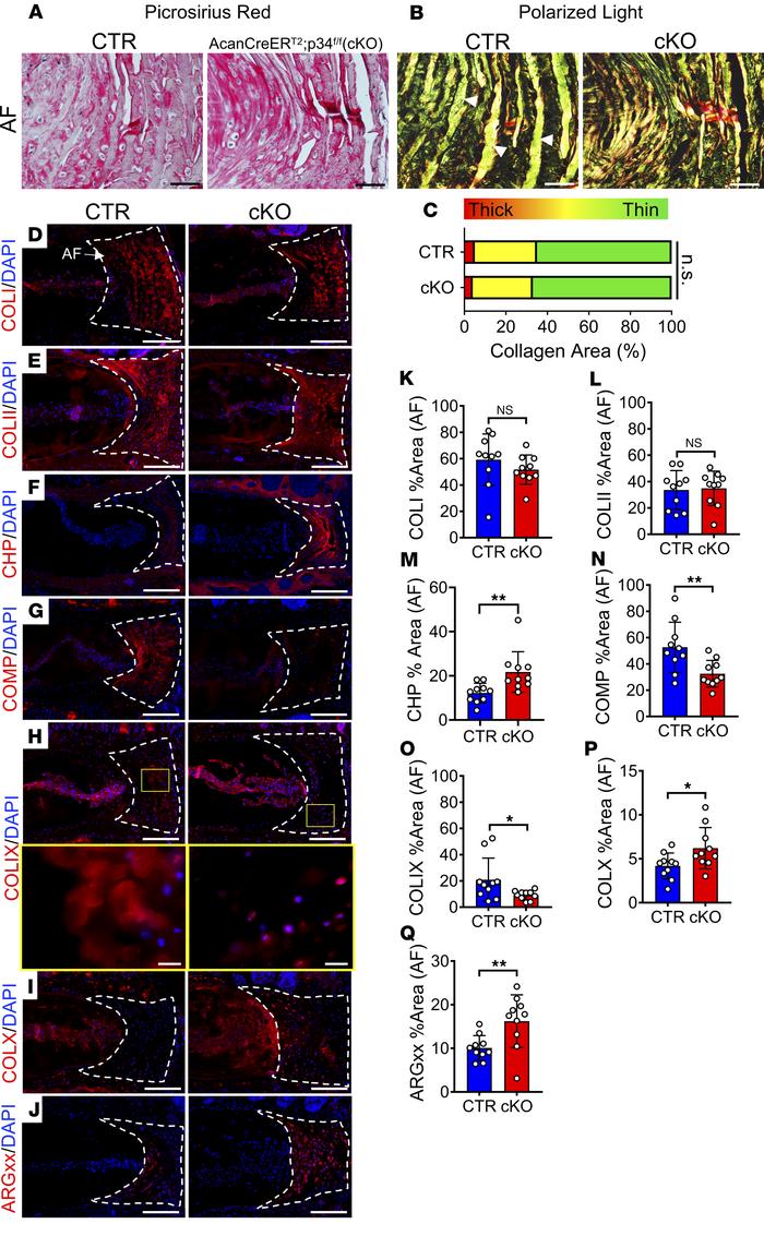 Annulus fibrosus degeneration in Arp2/3-deficient mice is characterized ...