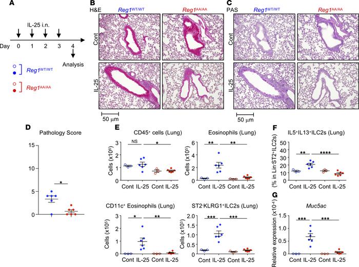 Attenuated IL-25–induced pulmonary inflammation in Regnase-1AA/AA mice.
...