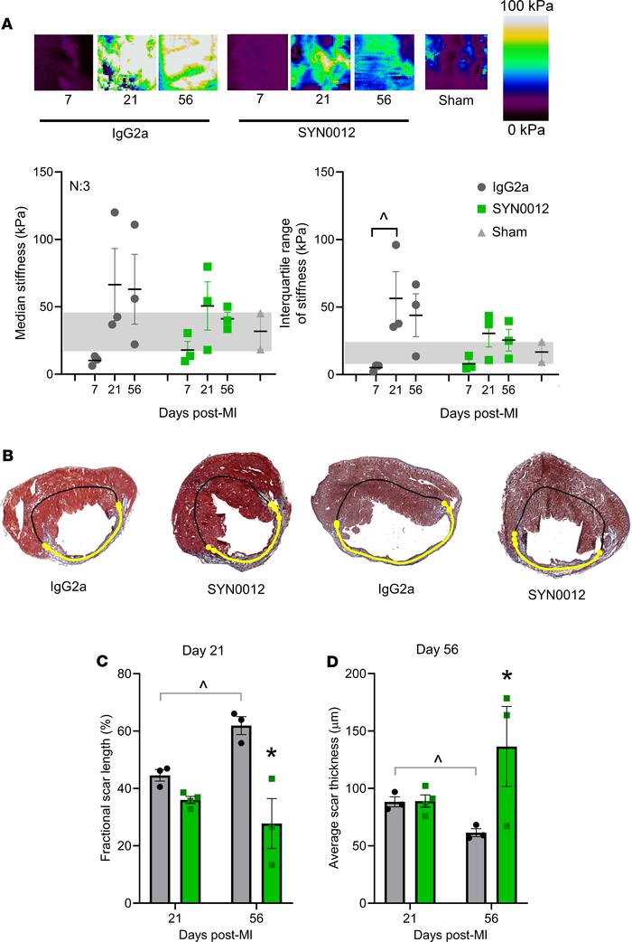 CDH11 blockade limits fibrotic remodeling after MI.
Atomic force microsc...
