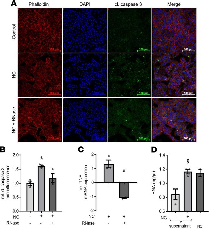 RNase 1 treatment results in decrease of cleaved caspase-3 immunofluores...