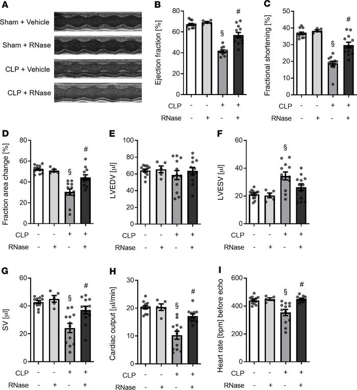 RNase 1 treatment of mice with polymicrobial sepsis resulted in an impro...