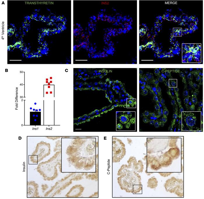 Insulin is expressed and produced in the choroid plexus.
(A) Fluorescent...