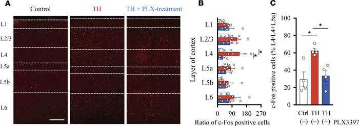 Microglial depletion prevents ectopic neuronal activity in the S1.
(A) R...