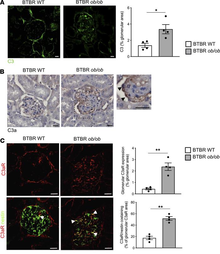 Glomerular complement activation in mice with type 2 DN.
Representative ...