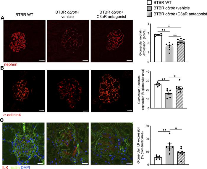 C3aR antagonist limits podocyte dysfunction in BTBR ob/ob mice.
Represen...