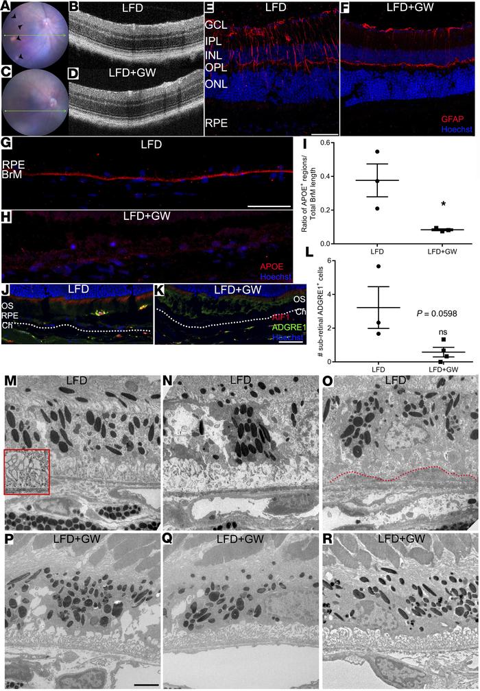 GW3965 diminishes pathogenic phenotypes associated with inflammation and...