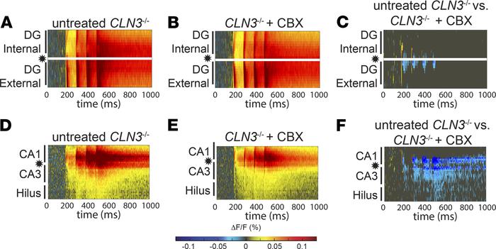 CBX, a drug that reduces storage burden, cannot correct hypoexcitability...
