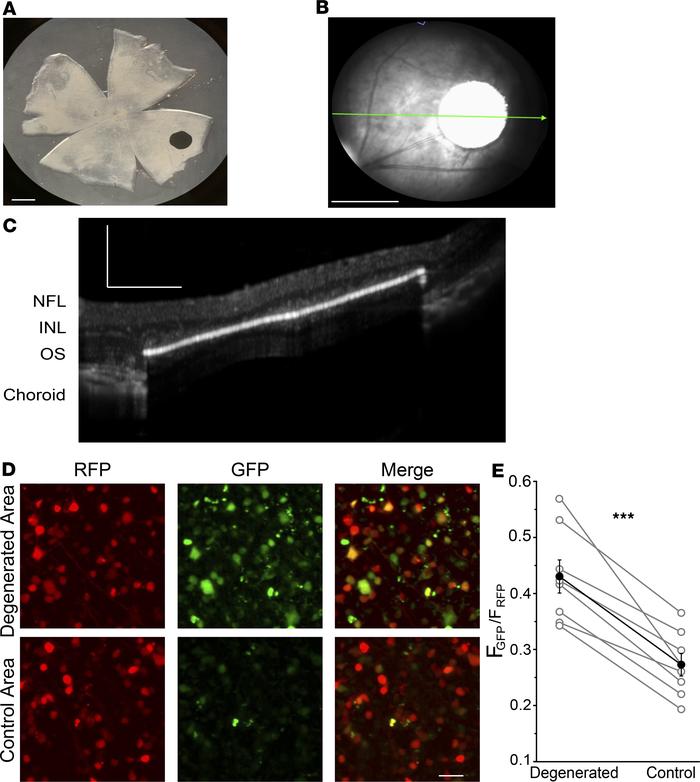Implant-evoked photoreceptor degeneration induces local RA signaling.
(A...