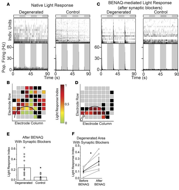 Implant-evoked photoreceptor degeneration induces localized BENAQ photos...