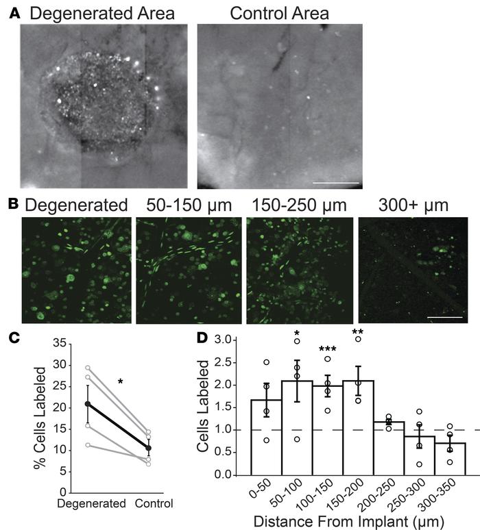 Implant-evoked photoreceptor degeneration induces local hyperpermeabilit...