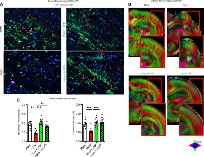 sPIF/H19 modulates myelination in vivo.
(A) Representative immunostainin...