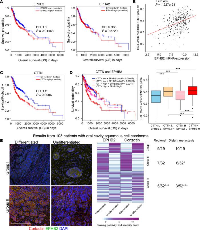 EPHB2 overexpression in HNSCC tumors correlates with patient survival an...