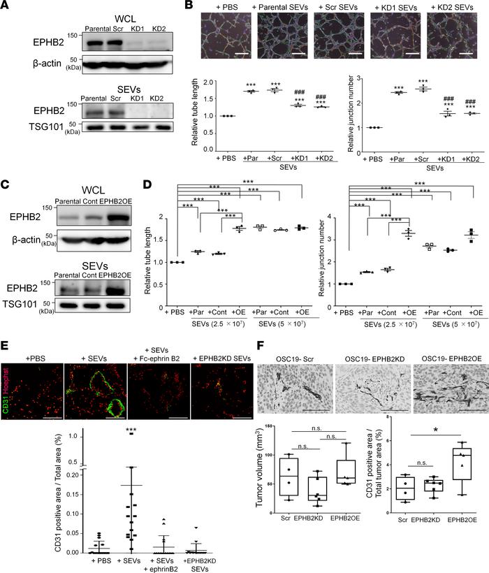 EPHB2 on SEVs drives in vitro tube formation and in vivo angiogenesis.
(...