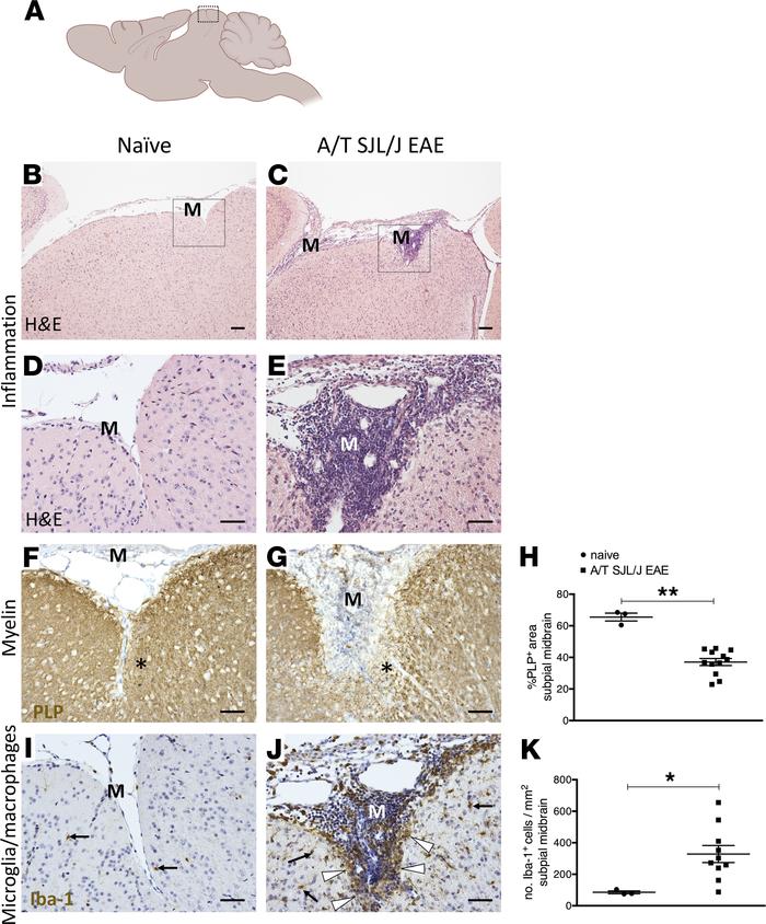 Meningeal inflammation in SJL/J adoptively transferred experimental auto...