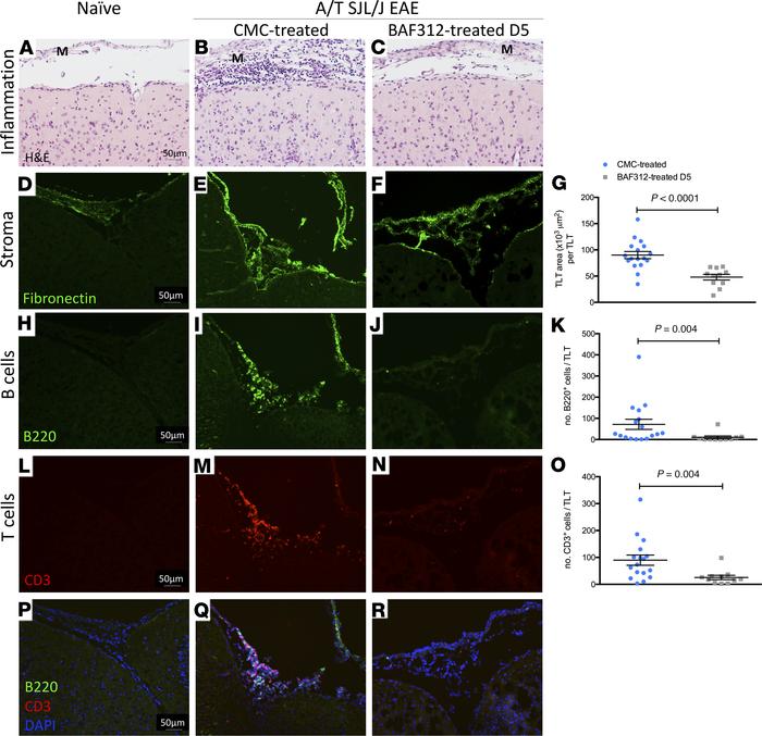 Therapeutic treatment with BAF312 reduces TLT area and the number of B a...