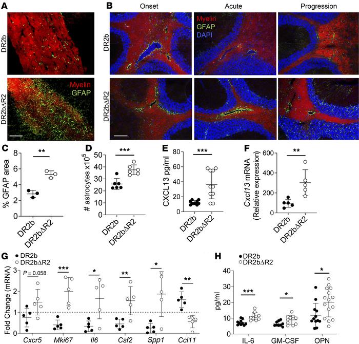 CNS TNFR2 limits chronic astrogliosis and astrocyte activation.
Passive ...