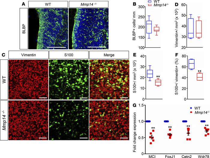 Examination of ependymal cell maturation and ciliogenesis in WT and Mmp1...