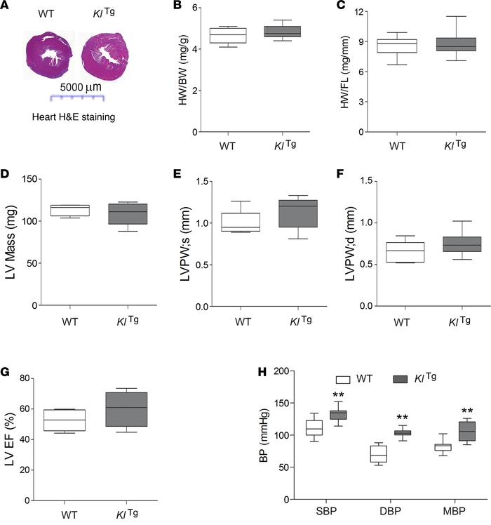 Heart and blood pressure phenotypes in KlTg mice.
(A) Cross sections of ...