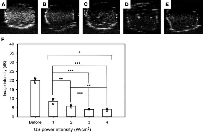 High-frequency US images of MBs before and after US sonication through t...