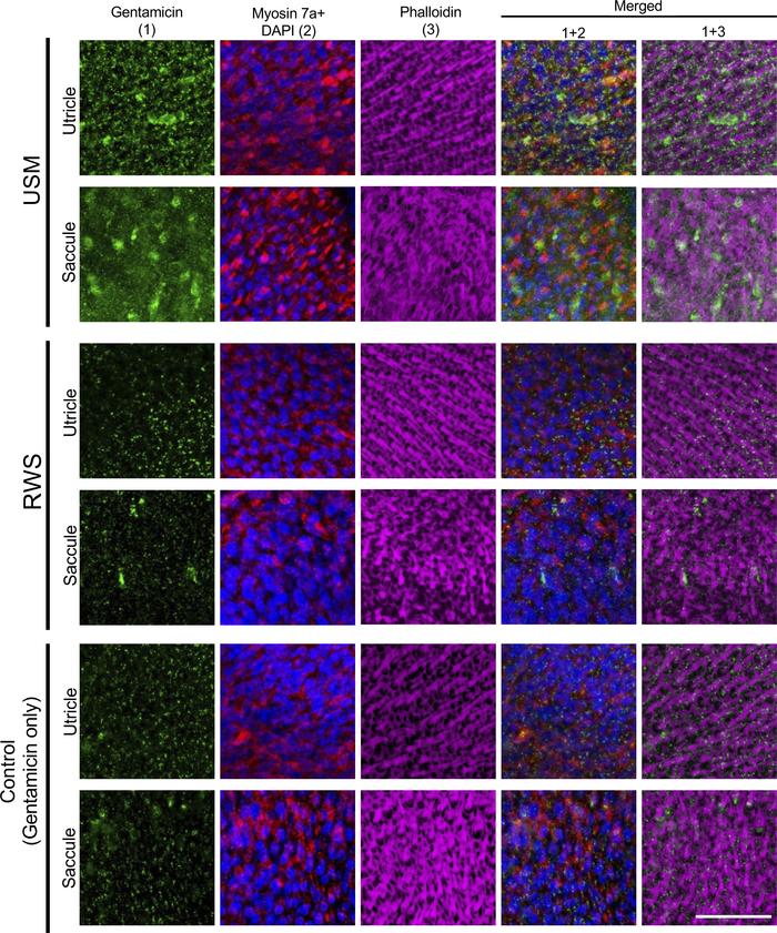 Exposure to USMBs enhances the cellular uptake of gentamicin in the utri...