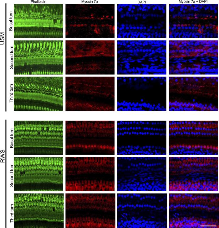 Exposure to USMB leads to a severer hair cell loss in the basal and seco...
