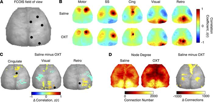 In utero OXT exposure affects functional brain organization in juvenile ...