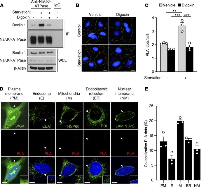Beclin 1 and Na+,K+-ATPase interact in cultured cells during starvation....