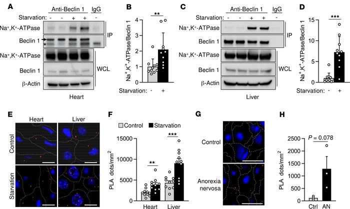 Beclin 1 and Na+,K+-ATPase interact in mouse and human tissues during st...