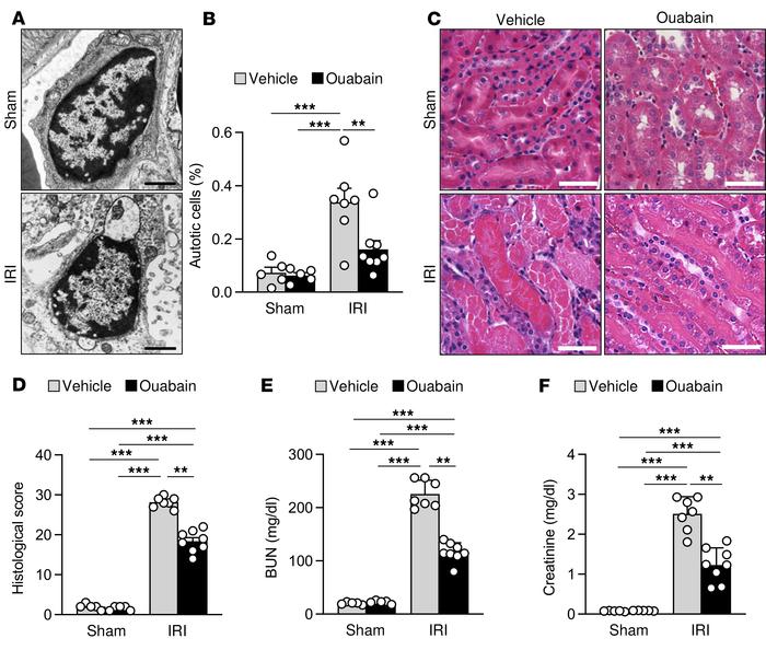 Ouabain decreases autotic cell death and improves outcome in renal IRI.
...