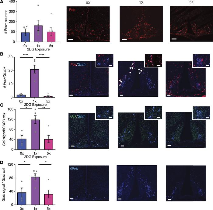 GHRH neuron activation by acute glucose deprivation is impaired by repea...