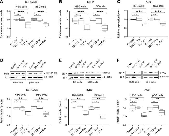 SERCA2B, RyR2, and AC9 expression in epithelial cells is altered by T ce...