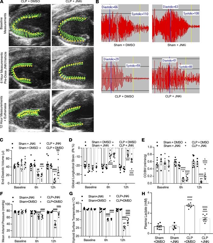 Pharmacological JNK inhibition increases preload and cardiac output and ...